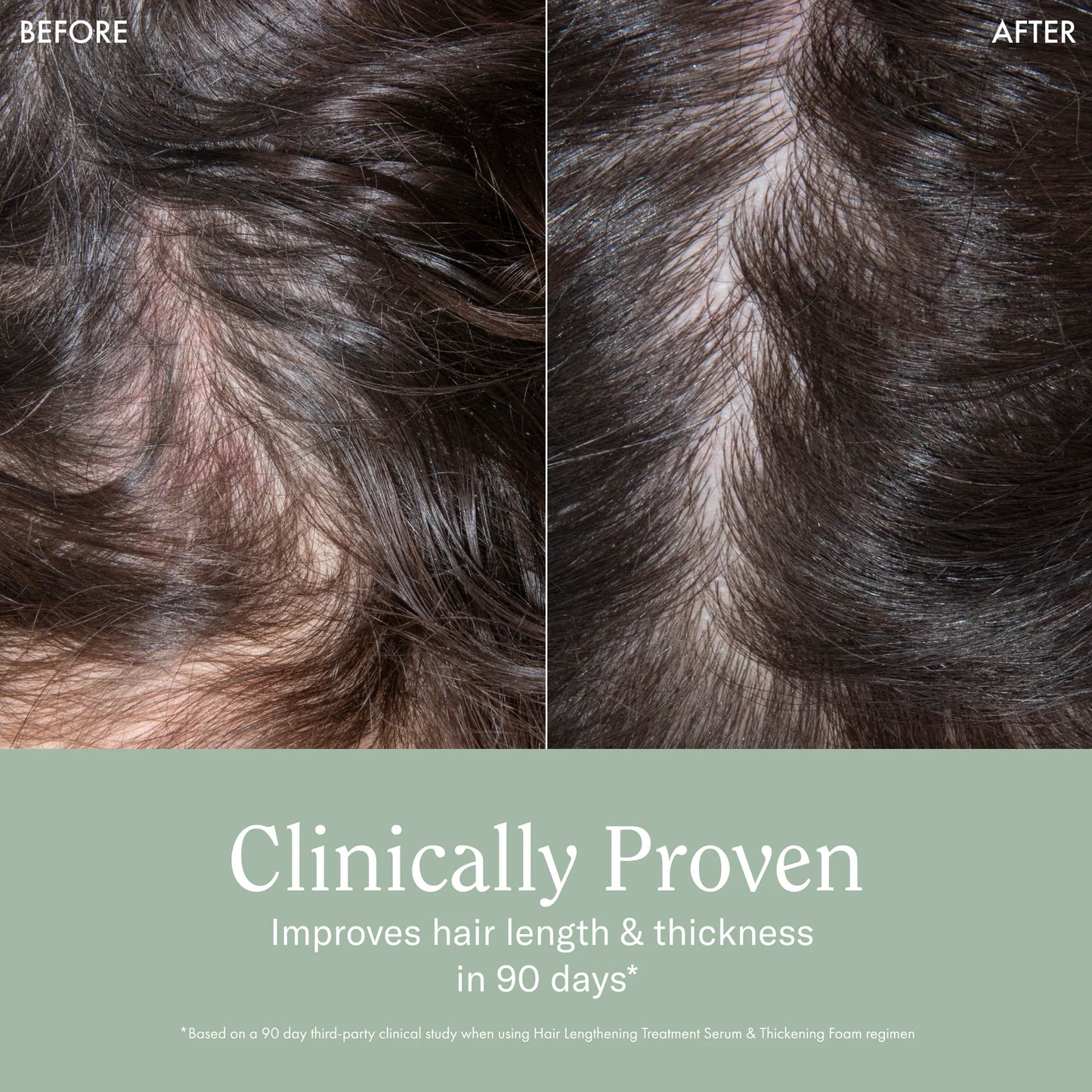 Rizoz Curls Hair Lengthening Treatment Serum